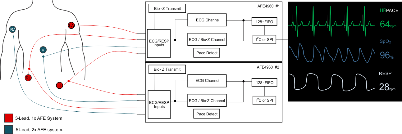 Capabilities Using One or Two AFE4960 Devices GUID-20211223-SS0I-9NWK-XVJN-6RT1NMVVWBML-low.gif